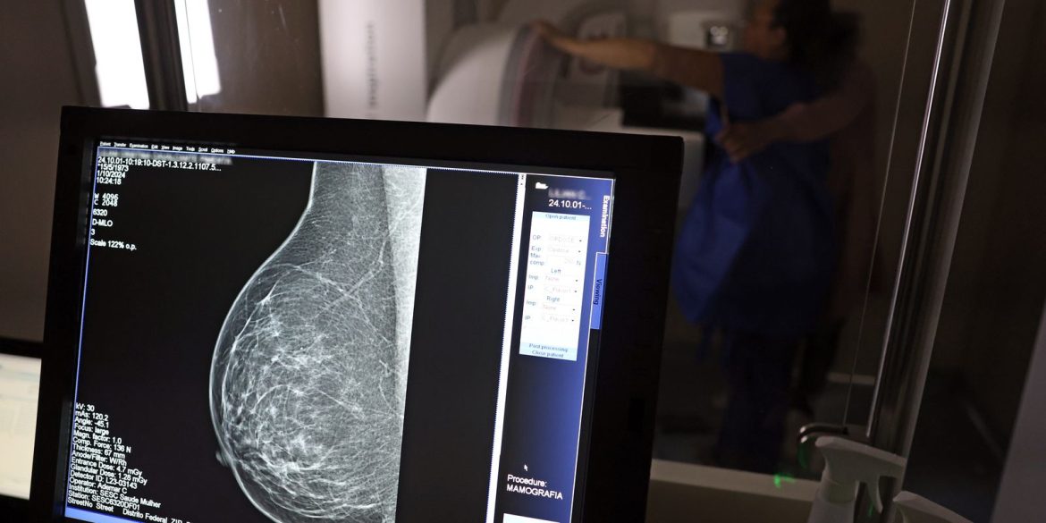 cancer-de-mama:-uma em-cada-tres pacientes tem-menos-de-50-anos