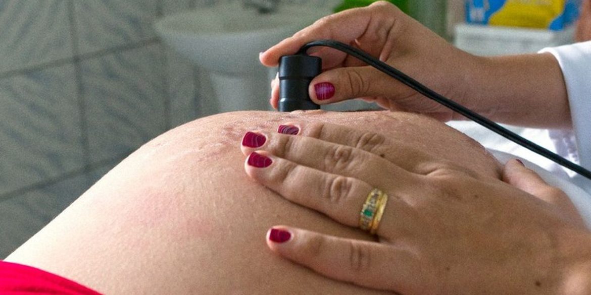 exame-pre-natal-reduz-chance-de-bebe-nascer-com-anomalia